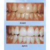 Dentifrice Oud Al Arak blancheur